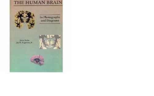 Human Brain in Photogs & Diagrams